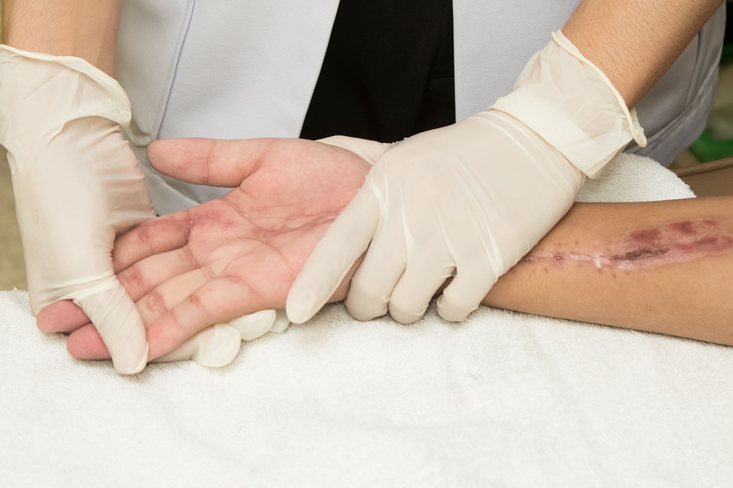 sanfte Mobilisation der Hand nach einer Operation